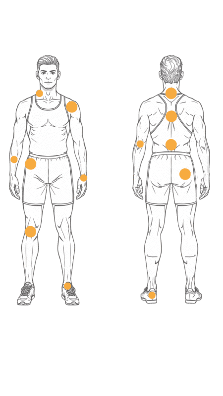 Eine skizzierte, männline Person, abgebildet von vorn und hinten in Sportbekleidung. Mit Orangenen Punkten werden die verschiedenen Problemstellen der genannten Krankheitsbilder verbindlich.